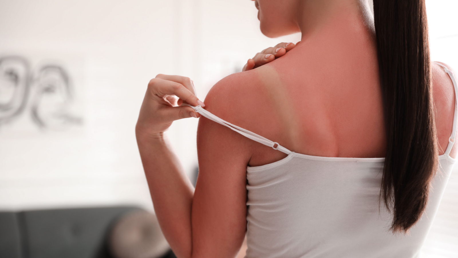 sun exposure